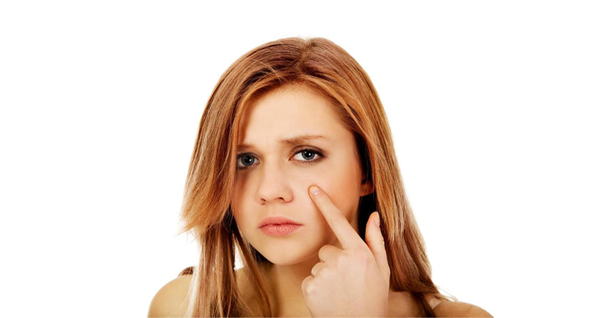 ترفندهای کاهش تیرگی دور چشم