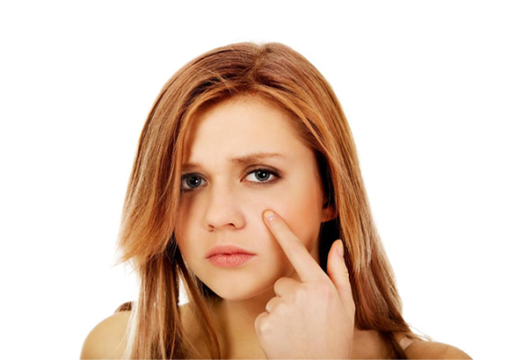 ترفندهای کاهش تیرگی دور چشم